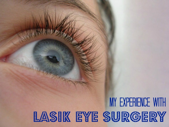 My Experience With LASIK Eye Surgery